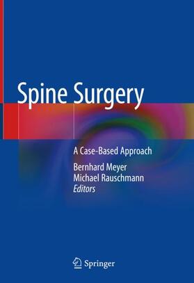 Rauschmann / Meyer |  Spine Surgery | Buch |  Sack Fachmedien