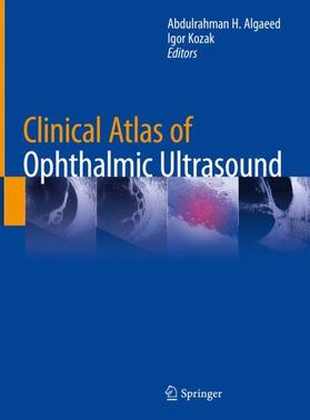 Kozak / Algaeed |  Clinical Atlas of Ophthalmic Ultrasound | Buch |  Sack Fachmedien