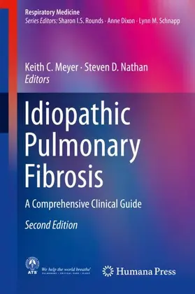 Nathan / Meyer |  Idiopathic Pulmonary Fibrosis | Buch |  Sack Fachmedien