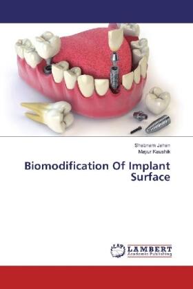Jahan / Kaushik |  Biomodification Of Implant Surface | Buch |  Sack Fachmedien