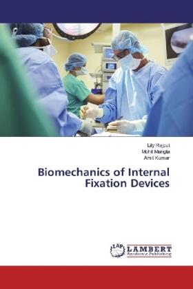 Rajput / Mangla / Kumar |  Biomechanics of Internal Fixation Devices | Buch |  Sack Fachmedien