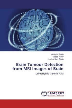 Yadav / Singh |  Brain Tumour Detection from MRI Images of Brain | Buch |  Sack Fachmedien