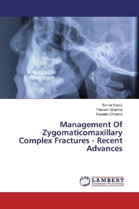 Kapila / Sharma / Chhabra |  Management Of Zygomaticomaxillary Complex Fractures - Recent Advances | Buch |  Sack Fachmedien