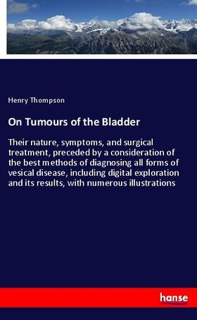 Thompson |  On Tumours of the Bladder | Buch |  Sack Fachmedien