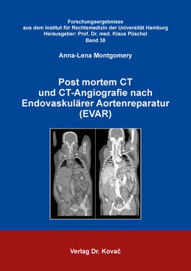 Montgomery |  Post mortem CT und CT-Angiografie nach Endovaskulärer Aortenreparatur (EVAR) | Buch |  Sack Fachmedien