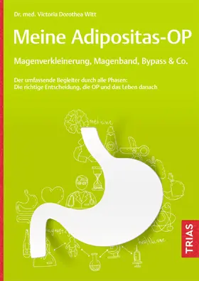 Witt |  Meine Adipositas-OP. Magenverkleinerung, Magenband, Bypass & Co. | Buch |  Sack Fachmedien