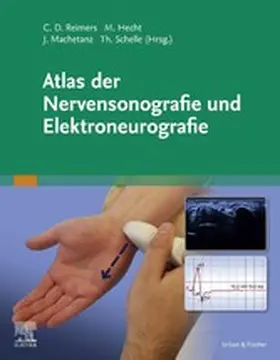 Reimers / Hecht / Machetanz |  Atlas der Nervensonografie und Elektroneurografie | eBook | Sack Fachmedien