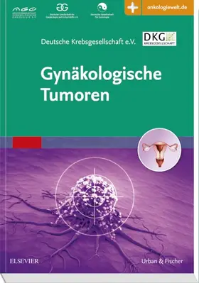  Gynäkologische Tumoren | Buch |  Sack Fachmedien