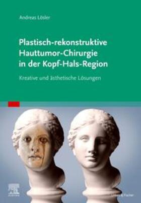 Lösler |  Plastisch-rekonstruktive Hauttumor-Chirurgie in der Kopf-Hals-Region | Buch |  Sack Fachmedien