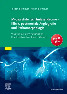 Barmeyer |  Myokardiale Ischämiesyndrome - Klinik, postmortale Angiografie und Pathomorphologie | Buch |  Sack Fachmedien