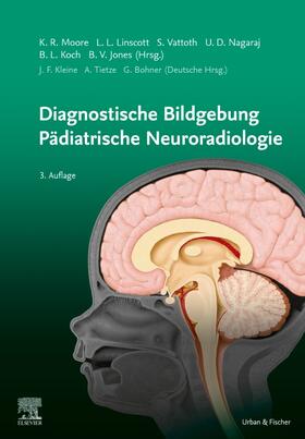 Moore |  Diagnostische Bildgebung Pädiatrische Neuroradiologie | Buch |  Sack Fachmedien