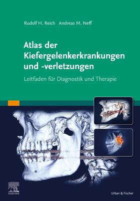 Neff / Reich |  Atlas der Kiefergelenkerkrankungen und -verletzungen | Buch |  Sack Fachmedien