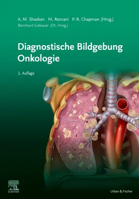 Gebauer / Akram M. / Shaaban |  Diagnostische Bildgebung Onkologie | Buch |  Sack Fachmedien