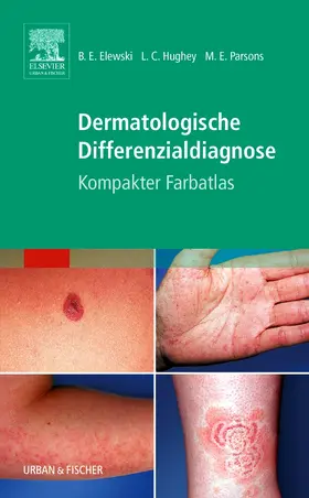 Elewski / Hughey / Parsons |  Dermatologische Differenzialdiagnose | Buch |  Sack Fachmedien