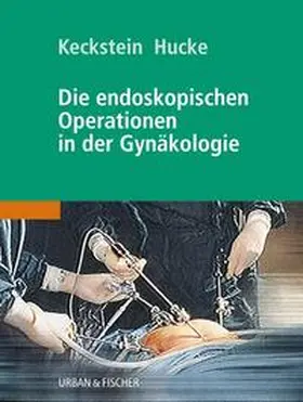 Keckstein / Hucke |  Die endoskopischen Operationen in der Gynäkologie | Buch |  Sack Fachmedien