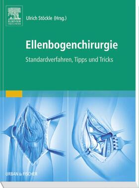 Stöckle |  Ellenbogenchirurgie | Buch |  Sack Fachmedien