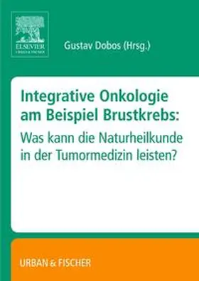 Dobos |  Integrative Onkologie am Beispiel Brustkrebs | Buch |  Sack Fachmedien