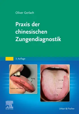 Gerlach |  Praxis der chinesischen Zungendiagnostik | Buch |  Sack Fachmedien