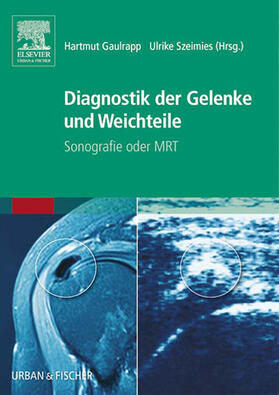 Gaulrapp / Szeimies |  Diagnostik der Gelenke und Weichteile | eBook | Sack Fachmedien