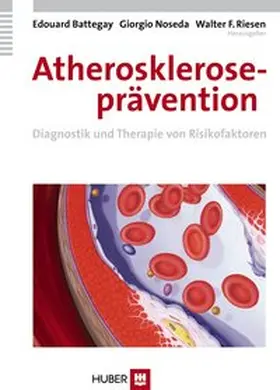 Battegay / Noseda / Riesen |  Atheroskleroseprävention | Buch |  Sack Fachmedien