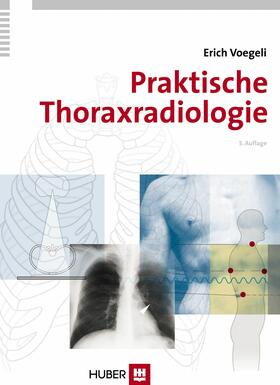 Voegeli |  Praktische Thoraxradiologie | eBook | Sack Fachmedien