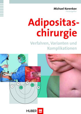 Korenkov |  Adipositaschirurgie | eBook | Sack Fachmedien