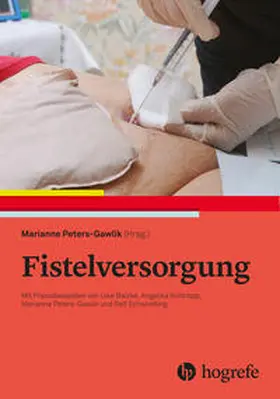 Peters-Gawlik |  Fistelversorgung | eBook | Sack Fachmedien