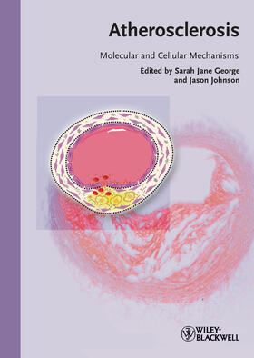 George / Johnson |  Atherosclerosis | Buch |  Sack Fachmedien