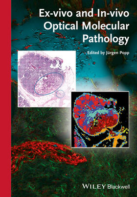 Popp |  Ex-vivo and In-vivo Optical Molecular Pathology | Buch |  Sack Fachmedien