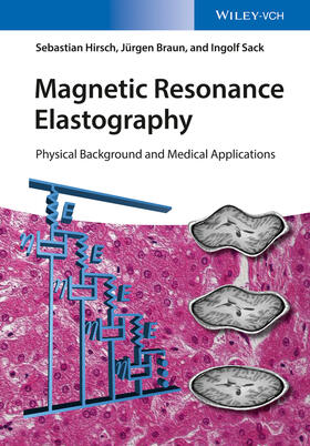Hirsch / Braun / Sack |  Hirsch, S: Magnetic Resonance Elastography | Buch |  Sack Fachmedien