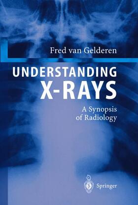 van Gelderen |  Understanding X-Rays | Buch |  Sack Fachmedien