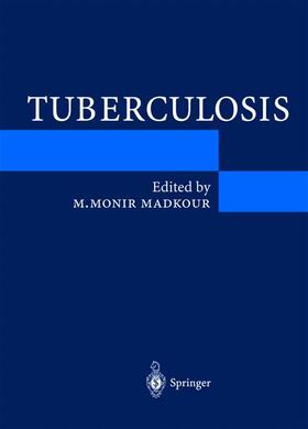 Madkour |  Tuberculosis | Buch |  Sack Fachmedien