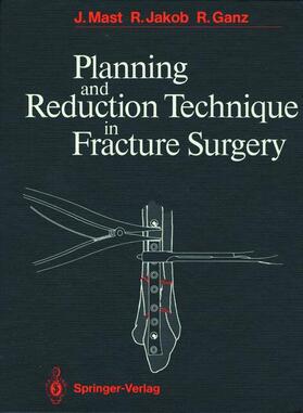Jakob / Mast / Ganz |  Planning and Reduction Technique in Fracture Surgery | Buch |  Sack Fachmedien