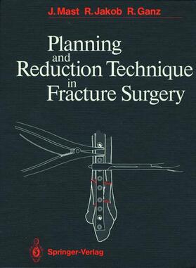 Mast / Jakob / Ganz |  Planning and Reduction Technique in Fracture Surgery | Buch |  Sack Fachmedien