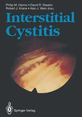 Hanno / Staskin / Krane |  Interstitial Cystitis | Buch |  Sack Fachmedien