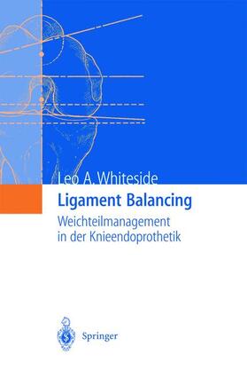 Whiteside |  Ligament Balancing | Buch |  Sack Fachmedien