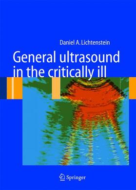 Lichtenstein |  General Ultrasound in the Critically Ill | Buch |  Sack Fachmedien