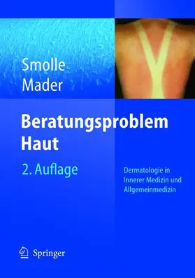 Smolle / Mader |  Beratungsproblem Haut | Buch |  Sack Fachmedien