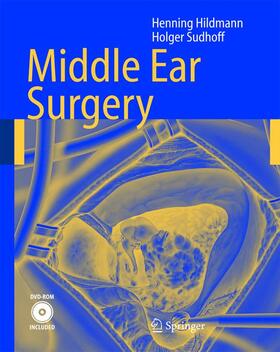 Sudhoff / Hildmann |  Middle Ear Surgery | Buch |  Sack Fachmedien