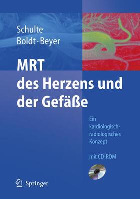 Schulte / Beyer / Boldt |  MRT des Herzens und der Gefäße | Buch |  Sack Fachmedien