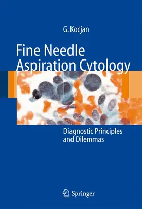 Kocjan |  Fine Needle Aspiration Cytology | Buch |  Sack Fachmedien