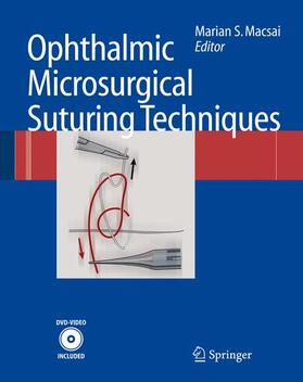 Macsai |  Ophthalmic Microsurgical Suturing Techniques | Buch |  Sack Fachmedien