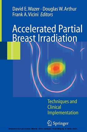 Wazer / Arthur / Vicini |  Accelerated Partial Breast Irradiation | eBook | Sack Fachmedien