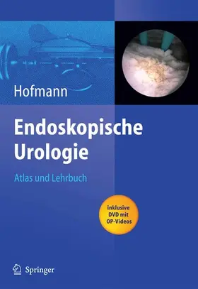 Hofmann |  Endoskopische Urologie | eBook | Sack Fachmedien