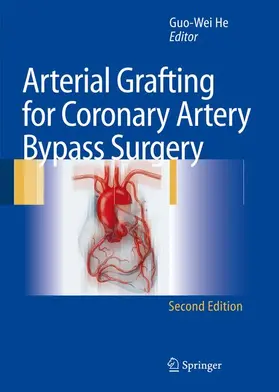 He |  Arterial Grafting for Coronary Artery Bypass Surgery | Buch |  Sack Fachmedien