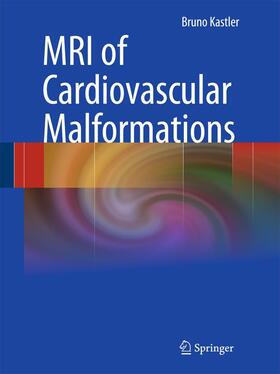 Kastler |  MRI of Cardiovascular Malformations | Buch |  Sack Fachmedien