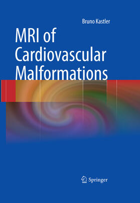 Kastler |  MRI of Cardiovascular Malformations | eBook | Sack Fachmedien