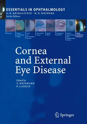 Larkin / Reinhard |  Cornea and External Eye Disease | Buch |  Sack Fachmedien