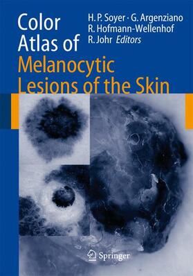 Soyer / Johr / argenziano |  Color Atlas of Melanocytic Lesions of the Skin | Buch |  Sack Fachmedien