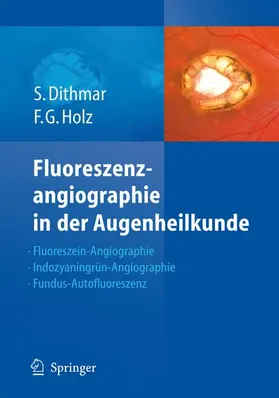 Holz / Dithmar |  Fluoreszenzangiographie in der Augenheilkunde | Buch |  Sack Fachmedien